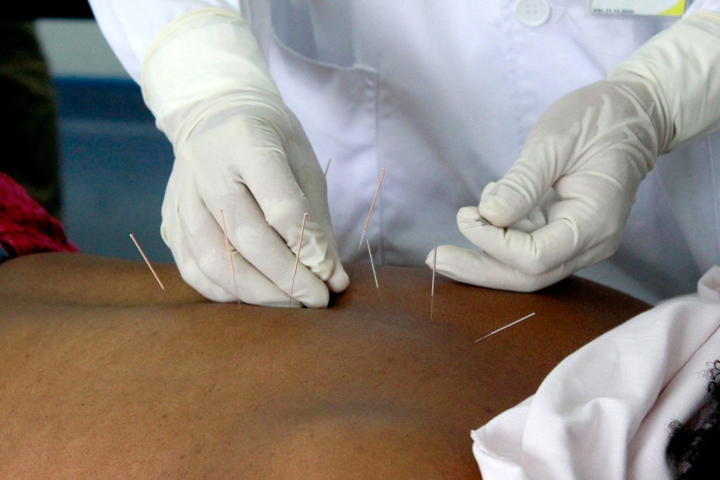 medicina tradicional chinesa